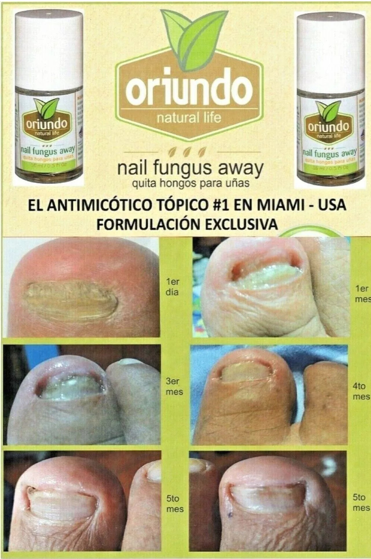 Oriundo Nail Fungus Treatment